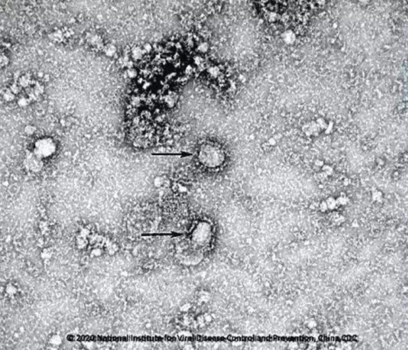 ▲新型冠狀病毒武漢株01。照片來(lái)源：國(guó)家病原微生物資源庫(kù)（中國(guó)疾病預(yù)防控制中心病毒病預(yù)防控制所）